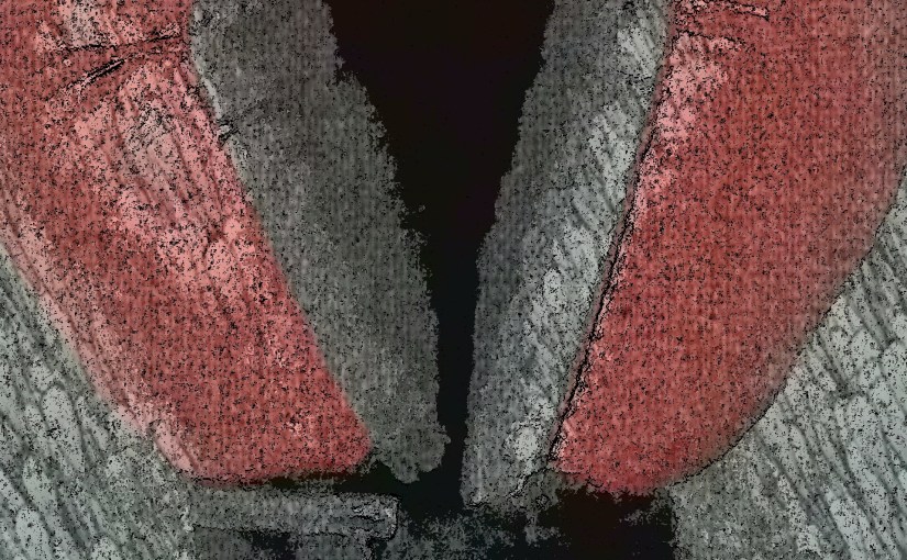 Donovan Dennis-Heart Of A&nbsp;Champion